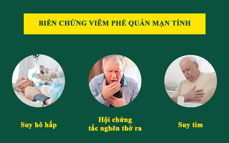 viêm phế quản mạn gây tăng áp lực động mạch phổi dễ gây suy tim